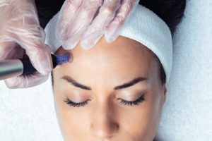 Microneedling / Platelet Rich Plasma Training – December 3, 2022